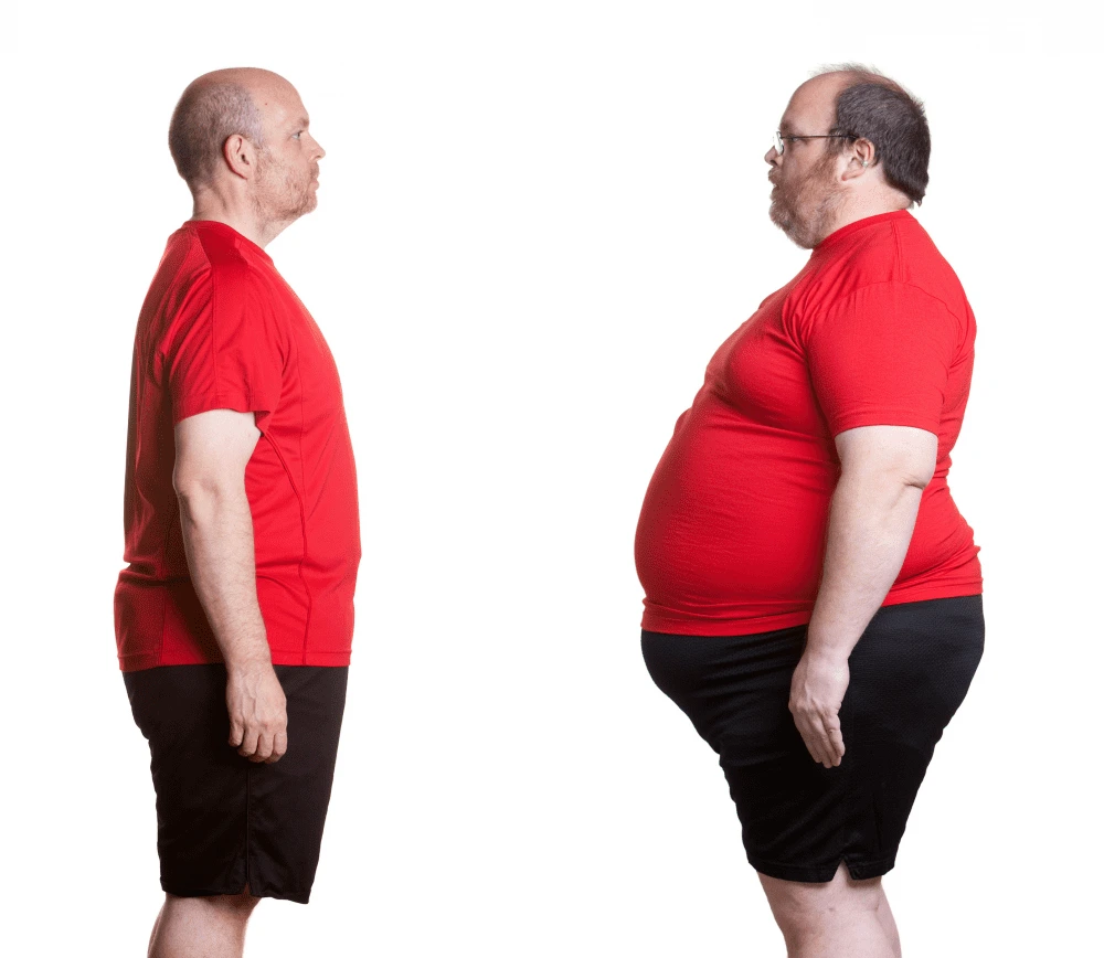 مینی بای پس معده، نه تنها به جلوه لاغری می‌افزاید بلکه بر خیلی از مشکلات مرتبط با چاقی مثل دیابت و فشارخون نیز تأثیرگذار است.
