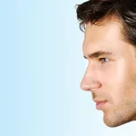 دوره بهبودی پس از جراحی بینی مردانه معمولاً تا چند هفته طول می‌کشد.