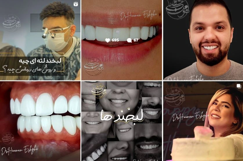 در تهران، وجود تعداد زیادی دندانپزشک زیبایی و ترمیمی با تجربه و تخصص متنوع است.