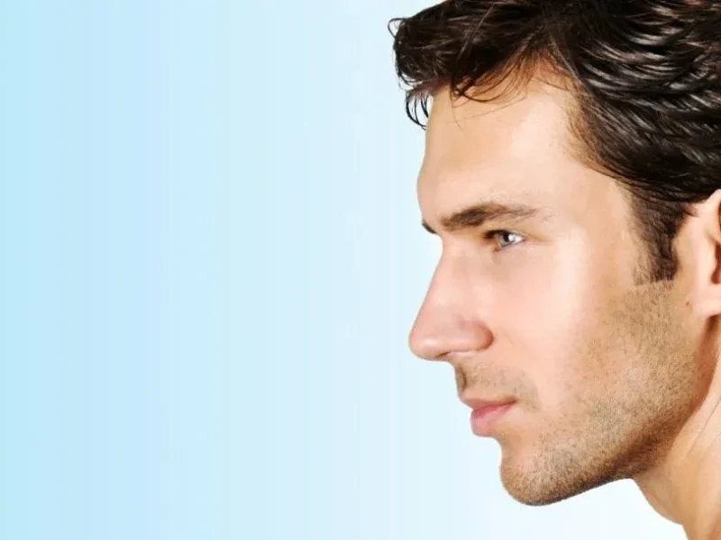 دوره بهبودی پس از جراحی بینی مردانه معمولاً تا چند هفته طول می‌کشد.