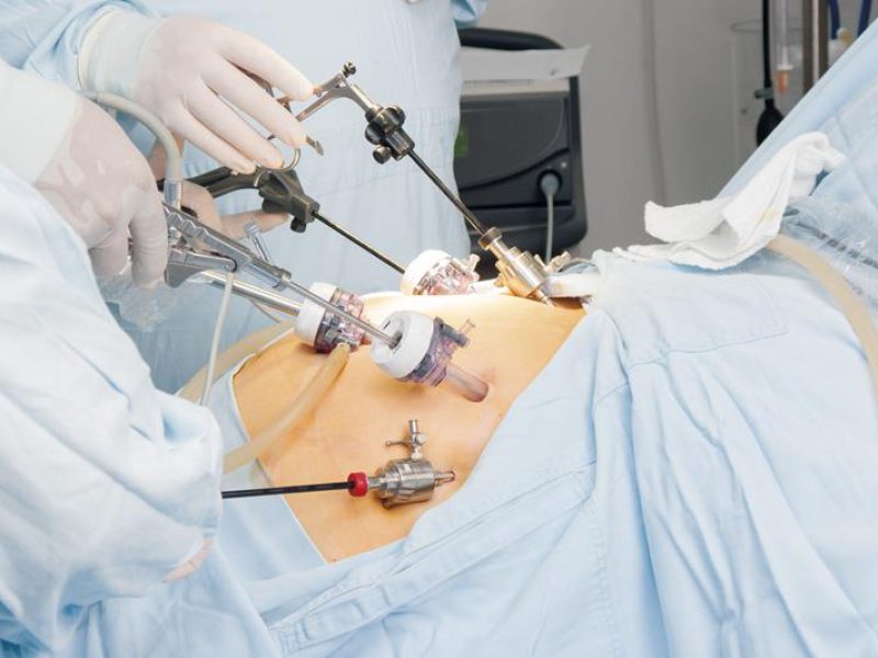 قبل از اجرای جراحی بای پس معده، انجام تست‌های پیش‌فرض و ارزیابی‌های جامع پزشکی ضروری است.