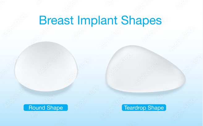 Breast augmentation, a type of breast surgery, provides the benefit of customizability