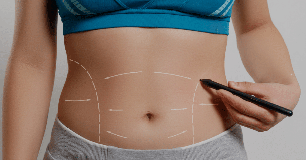 Abdominoplasty surgery can provide a flatter, more contoured abdomen by removing excess skin and fat.