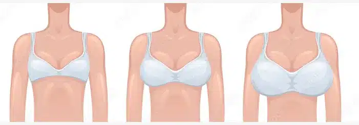 The benefits of mammoplasty extend to breast reconstruction