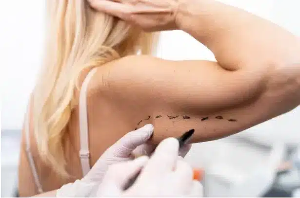 During a liposuction procedure, a surgeon uses specialized techniques to suction out unwanted fat cells, leading to a more sculpted and toned physique.
