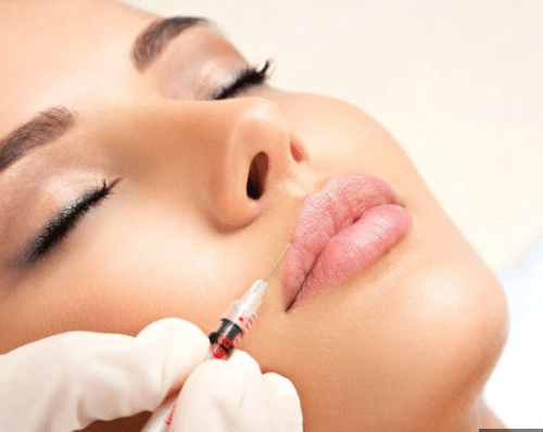 Many individuals opt for lip filler through lip injections due to the numerous benefits it offers, including plumper lips, better symmetry, and a smoother texture.