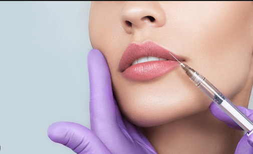 "Lip filler is a popular cosmetic treatment that involves a lip injection, providing numerous benefits such as enhanced volume, improved shape, and reduced appearance of fine lines.