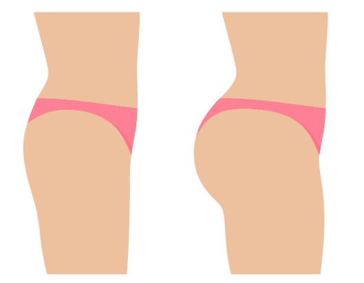 BBL, short for Brazilian Butt Lift, has gained significant popularity due to its ability to provide natural-looking results and improve body proportions.