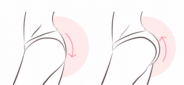 Several techniques are employed during a Brazilian Butt Lift to achieve the desired results.
