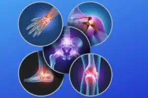 Orthopedic surgeries can effectively alleviate chronic pain caused by musculoskeletal conditions