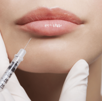 Lip augmentation is a popular cosmetic procedure that enhances the size and shape of the lips