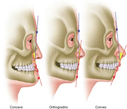 The transformative effects of orthognathic surgery, known as jaw surgery, can provide individuals