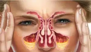 Understanding the different types of nose and throat treatments is essential for individuals seeking relief from congestion
