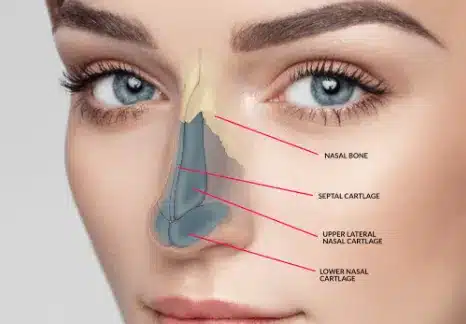 A successful nose job can provide permanent changes to the Roman nose, allowing you to enjoy the benefits for years to come.