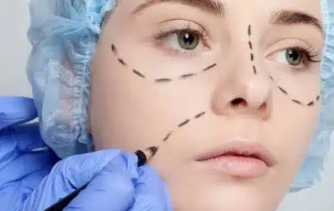 Exploring the different types of face surgery available after weight loss can help individuals choose the most suitable procedure to achieve their desired results.