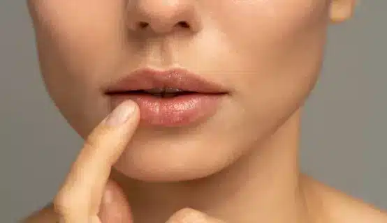 Whether you choose lip augmentation or opt for a more comprehensive lip cosmetic surgery, it's important to consult with a qualified plastic surgeon