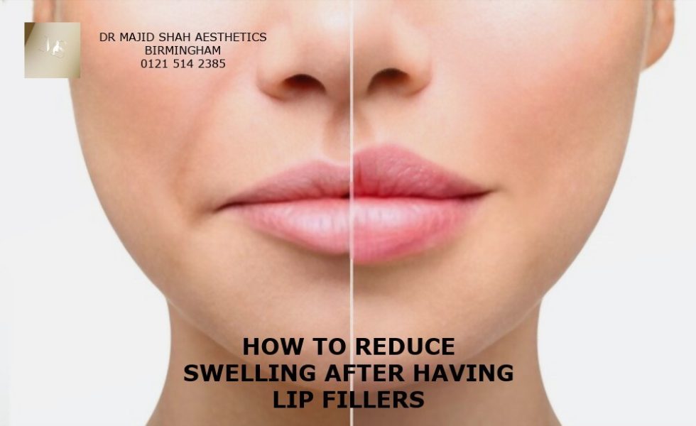 Another type of lip filler is collagen-based fillers, which contain collagen sourced from either human or bovine collagen.