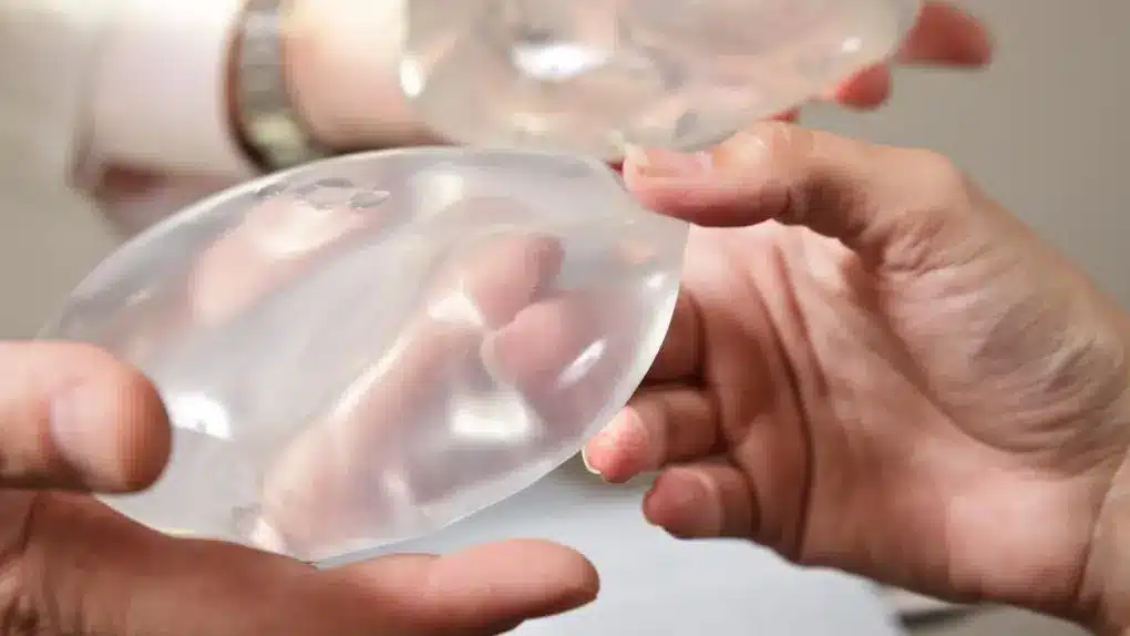 On October 27, 2021, the FDA took several actions to strengthen breast implant risk communication and help those who are considering breast implants make informed decisions.