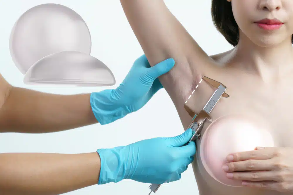 Additionally, aesthetic complications such as asymmetry, implant malposition, or dissatisfaction with the size or shape of the breasts can occur, requiring revision surgery to address.