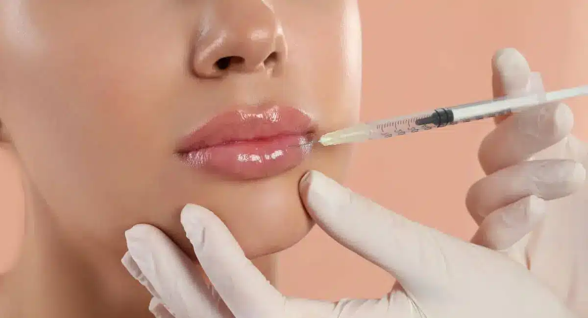 Furthermore, the complexity and extent of the lip lift procedure required can influence the overall cost.