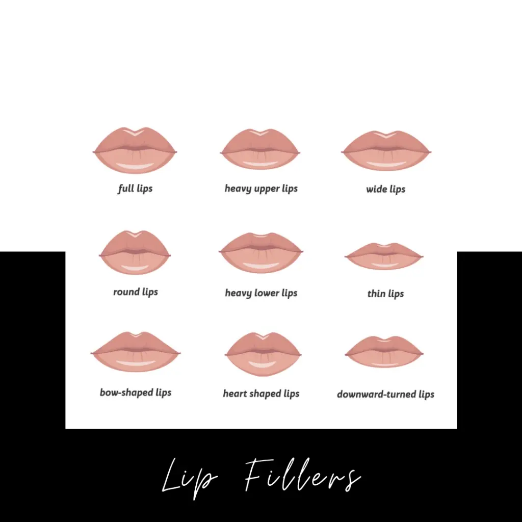 While most patients opt to undergo a lip lift procedure to correct a long philtrum and augment their lips, I wondered if the procedure could specifically improve the lack of tooth show I had following revision rhinoplasty.