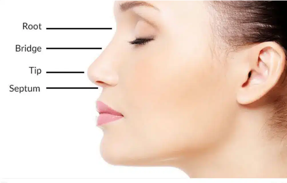 Nonsurgical rhinoplasty, also known as a liquid or non-invasive rhinoplasty, can achieve certain cosmetic enhancements to the nose, but it does have limitations compared to surgical rhinoplasty.
