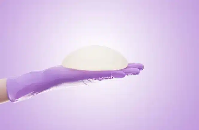 Patients should be well-informed about the potential side effects of breast implants.