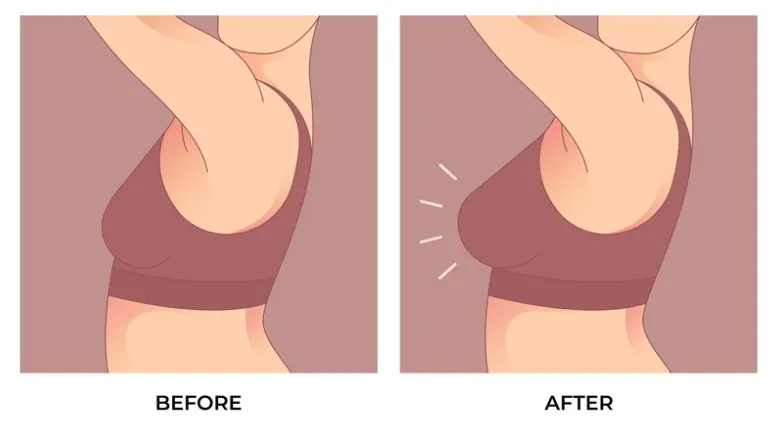 Understanding the different Types of Breast Augmentation is essential, but equally important is recognizing and addressing the Potential Risks of Breast Augmentation beforehand.