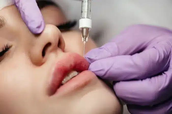 Many are questioning why the increasing cost of lip lift is outpacing inflation, especially when comparing the cost of lip lift to other similar cosmetic procedures.